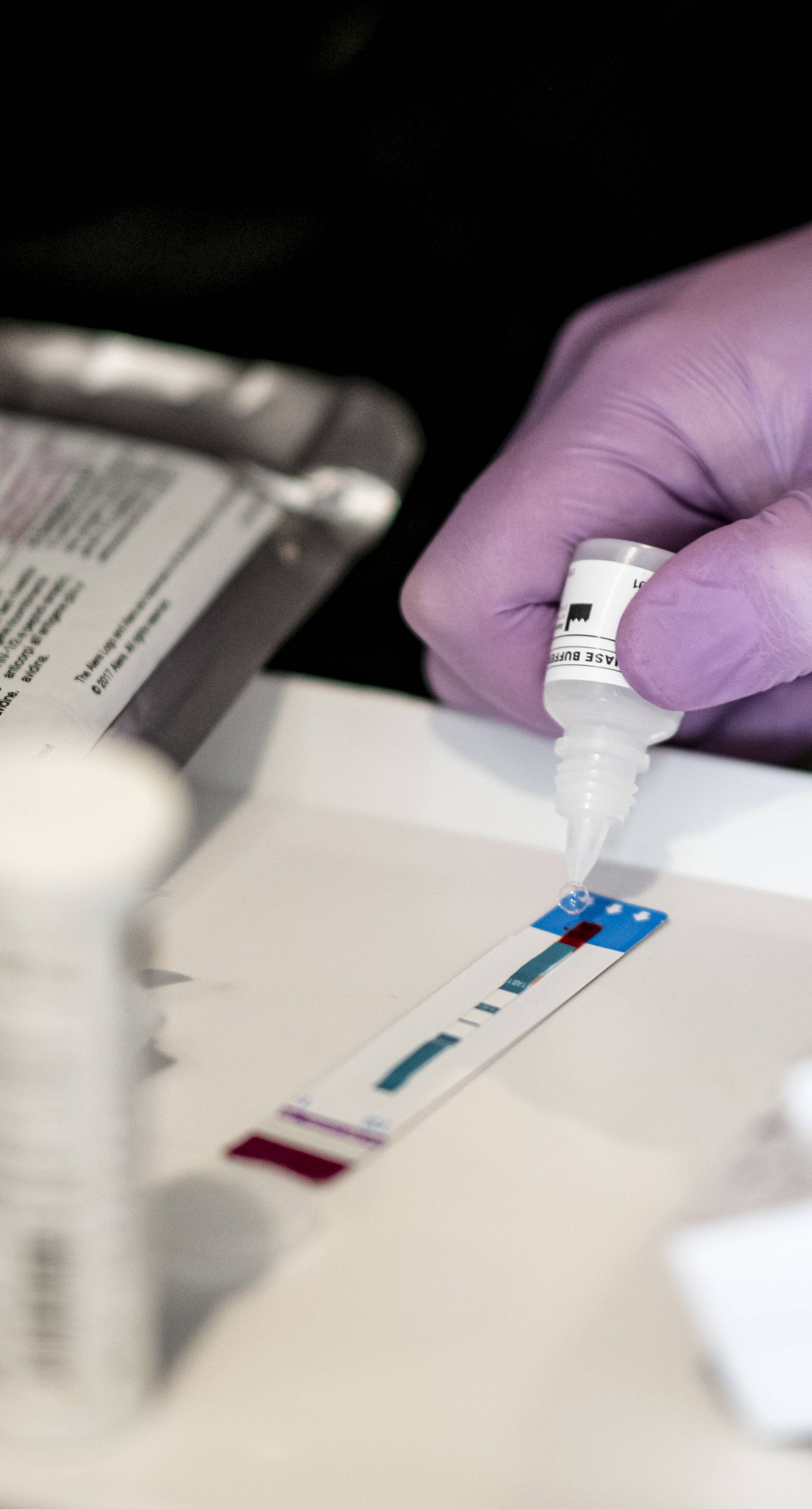 Eksperimentalno cjepivo protiv HIV-a nije se uspjelo realizirati