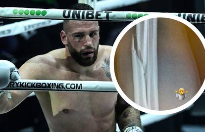 Evo kako je Plazibatu izgledala ruka. Danas Hrvat ponovno gazi