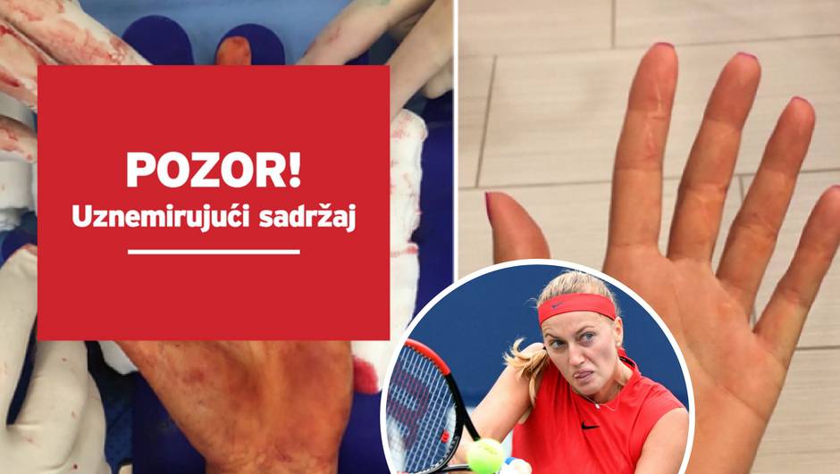 Jedva joj spasili igračku ruku, sad lovi titulu na Grand Slamu