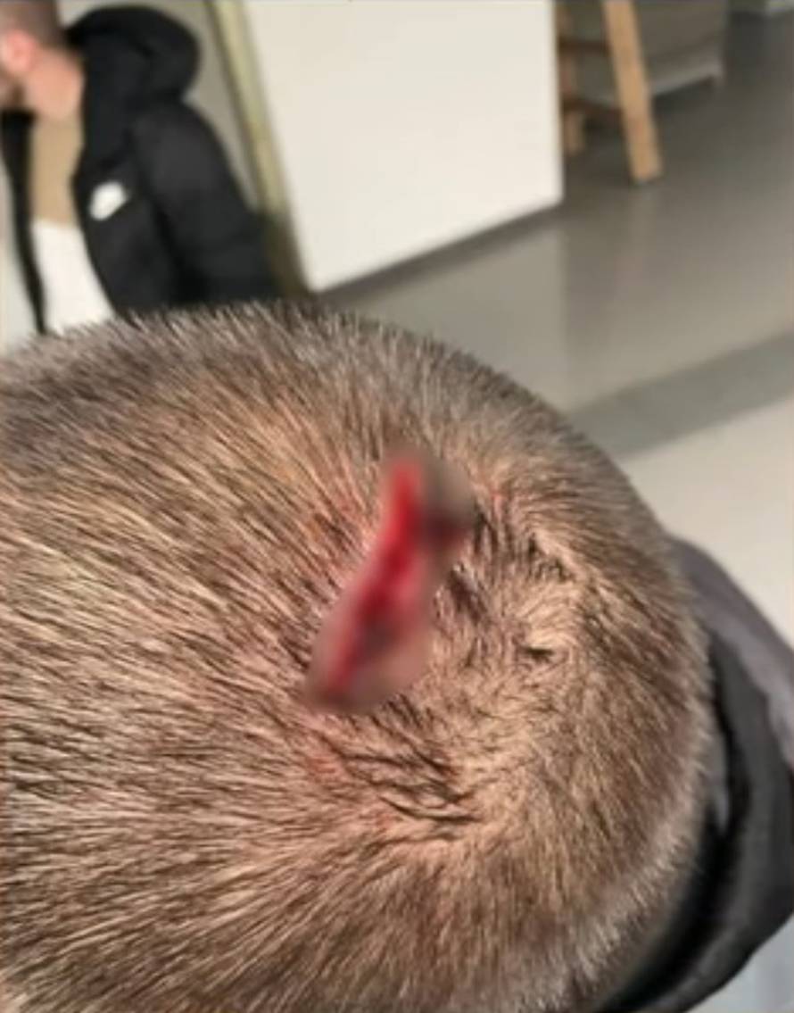 Srpska televizija objavila fotke pretučenih u Zadru. Policija je nastavila privoditi umiješane