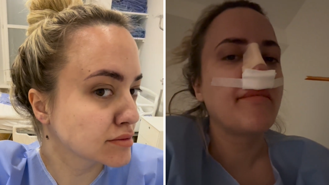 Meri Goldašić nakon operacije nosa za 24sata: 'Ne planiram ići više pod nož. Sve sam riješila...'
