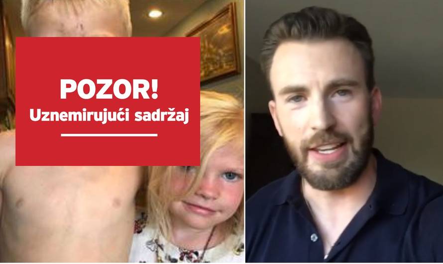 Glumac iznenadio dječaka koji je sestru spasio od psa, njegova snimka rasplakala je mnoge