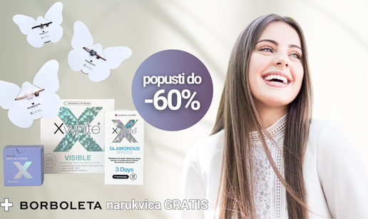 Xwhite® poklanja 60% popusta na tretman izbjeljivanja zubi i Borboleta narukvicu gratis!