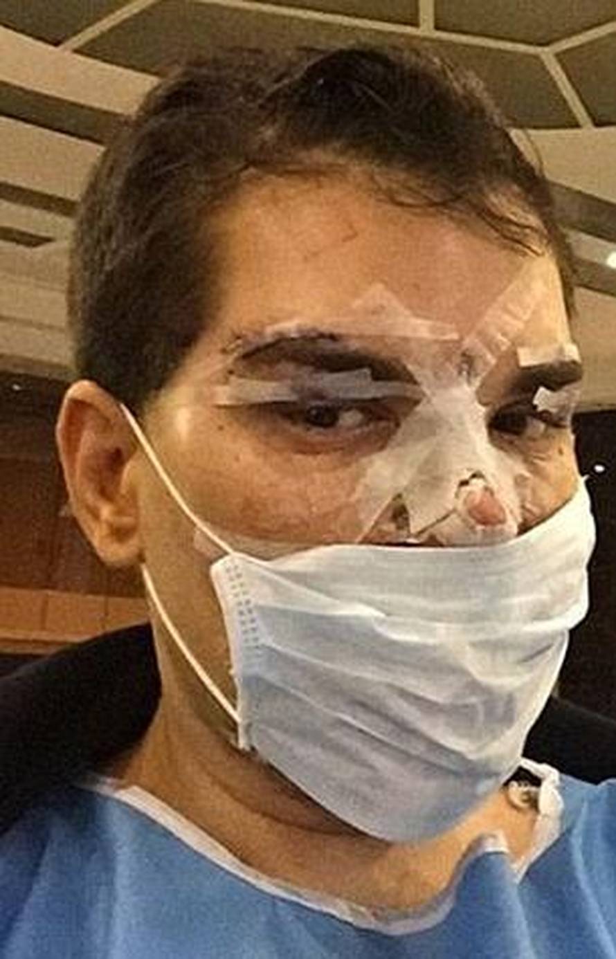 Bio je Ken pa Barbie: Ovisnik o nožu pokazao kako je izgledao