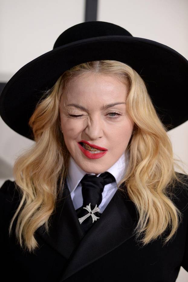 Poznata lica koja su se promijenila zbog velike koli?ine botoksa