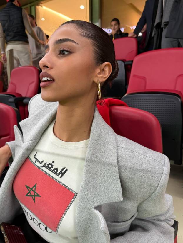 FOTO Anđeosko lice! Evo zašto se ova ljepotica nalazi na listi najzgodnijih modela na svijetu