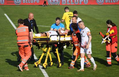 Igrač Gorice ima prijelome kao da je bio u prometnoj nesreći: Evo kad se vraća na teren