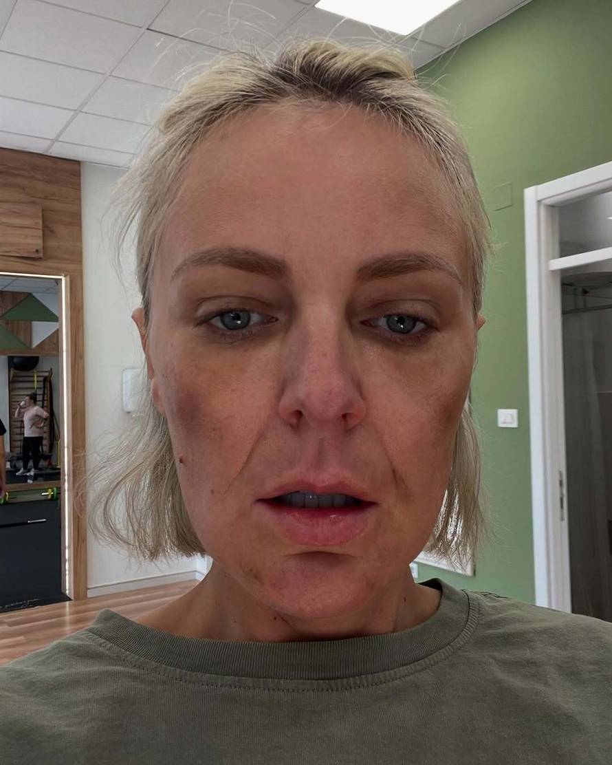 Stankica iz 'Savršenog': Traume od estetskih operacija su me potakle da učim za psihologa