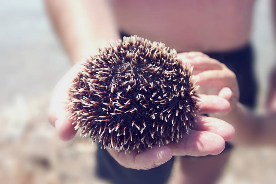 Što kada stanemo na ježinca, ubode nas osa ili opeče meduza