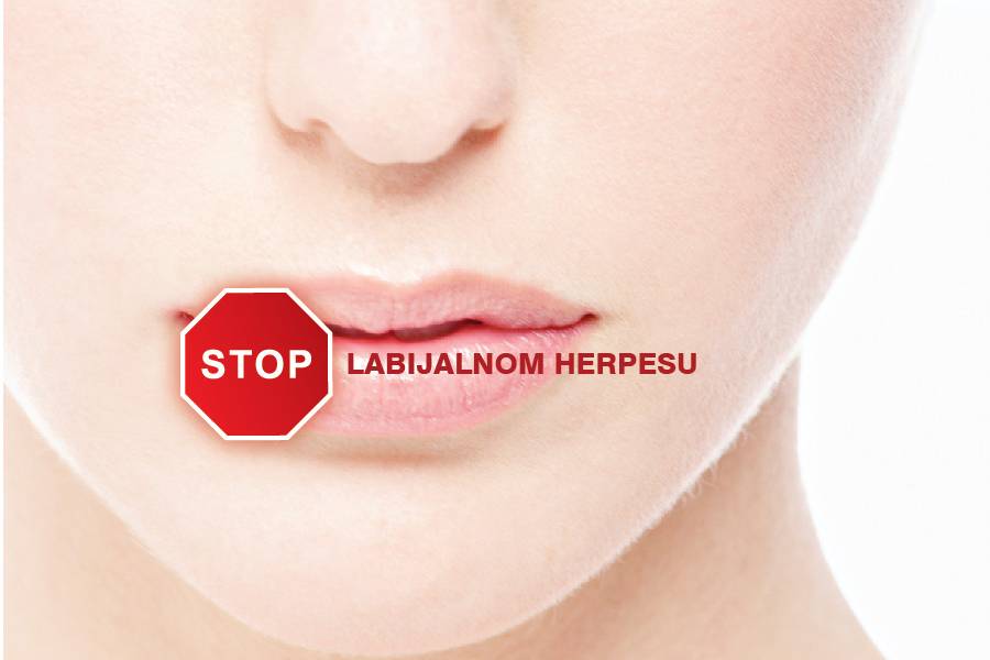 Nova generacija lijekova za herpes