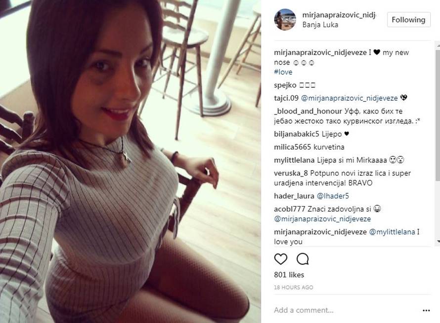 BB Mirjana smanjila nos: 'Što ti je s licem, ovo je strašno?!'