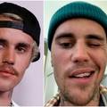 Justin Bieber oglasio se nakon što mu je lice paralizirano