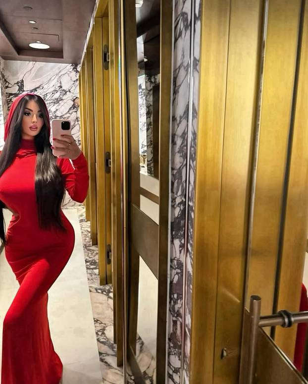 FOTO Brazilka Jennifer: Bila sam ovisna o estetskim zahvatima! Potrošila sam preko 800.000 $