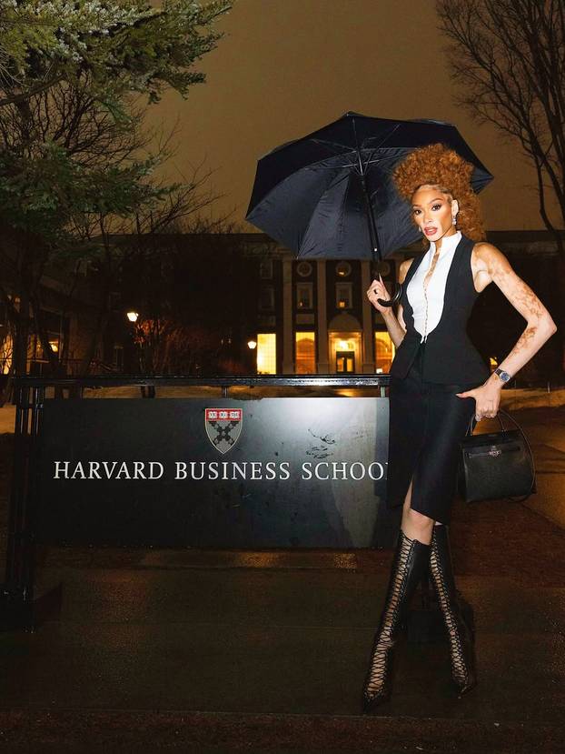 FOTO Rugali su joj se zbog bolesti, a danas je obožavaju zbog jedinstvenog izgleda