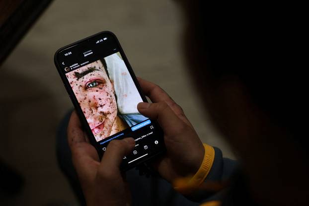 Former Ukrainian service member, who was wounded at a front line, comes to a clinic to treat scars, in Lviv