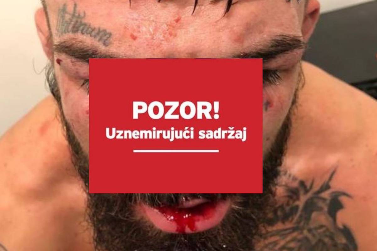 Luque kaznio Perryja: Možda i najgori lom nosa u UFC-u ikad