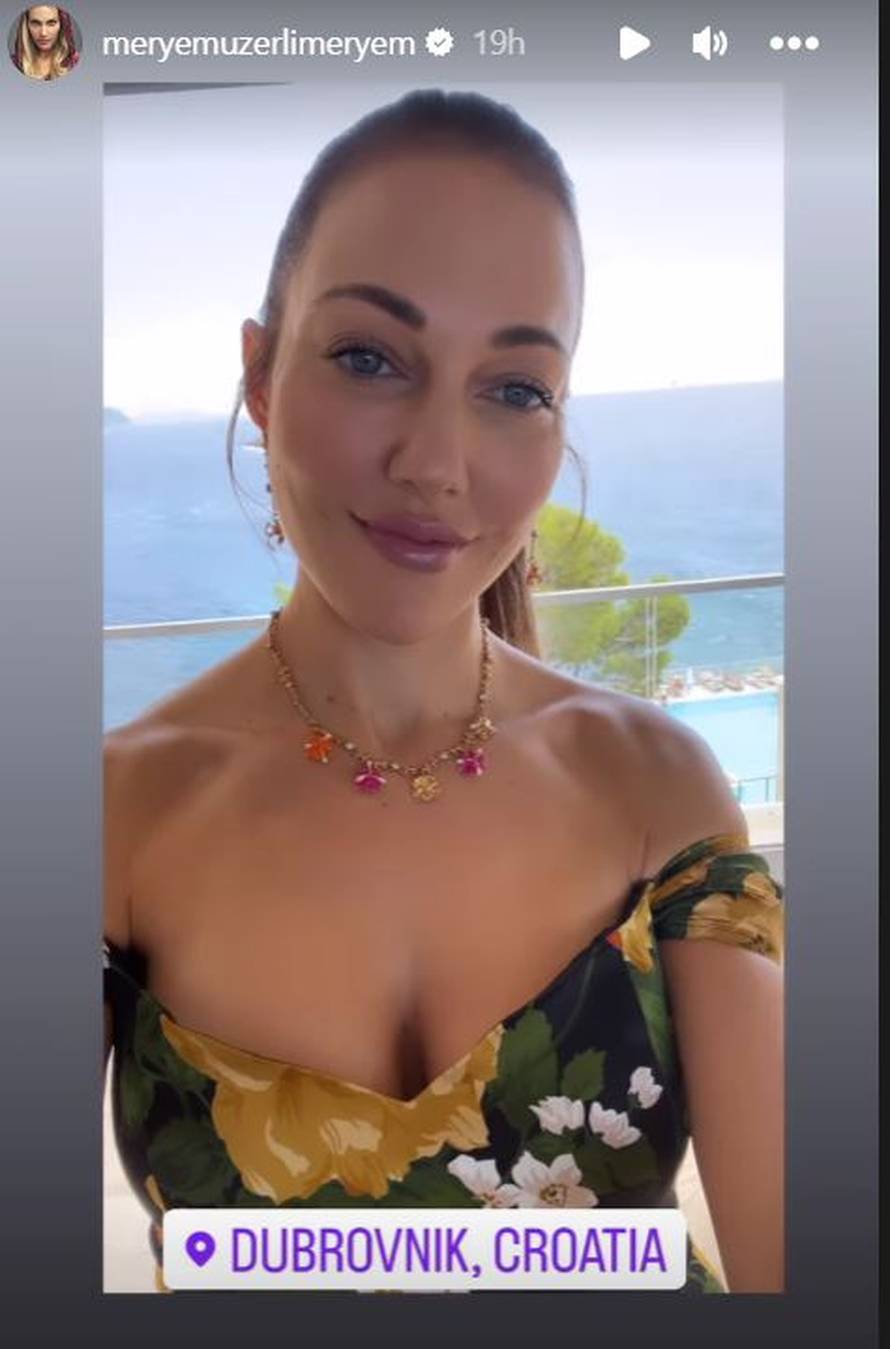 Hurem zablistala u plavome: Ne krije da je ubrizgavala botoks i već četiri puta povećavala usne