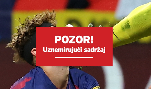 STRA&Scaron;NE SCENE Golman Atletica &ccaron;epovima u nos zvijezdi Barce! Poteklo dosta krvi. Le&zcaron;ao je...