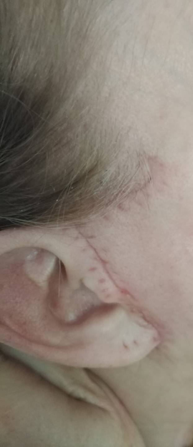 Na istog se estetskog kirurga žalila i Kristina Mandarina. Pogledajte kako je izgledala