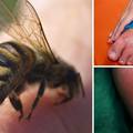 Ubodi pčela i osa: Evo kako se zaštiti i što učiniti nakon uboda