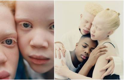 Rade kao  modeli, a glavni cilj im je podići svijest o albinizmu