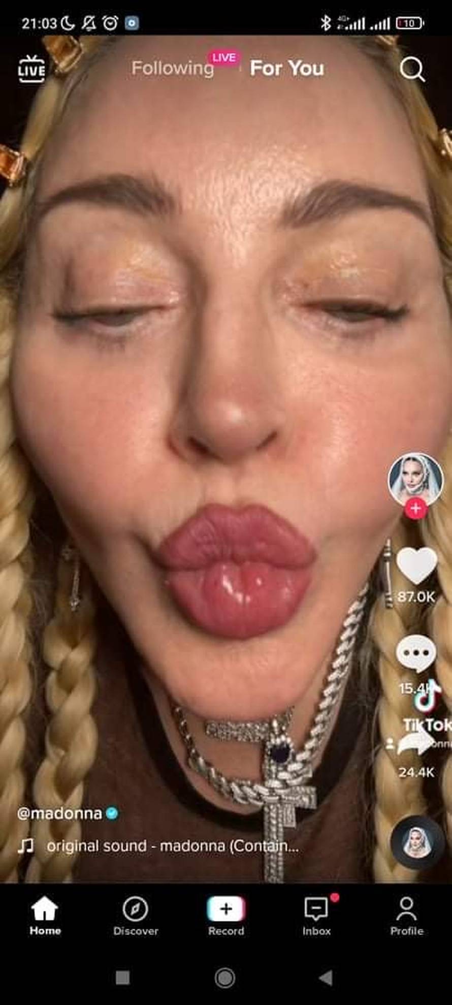 Madonna, što ti se dogodilo?