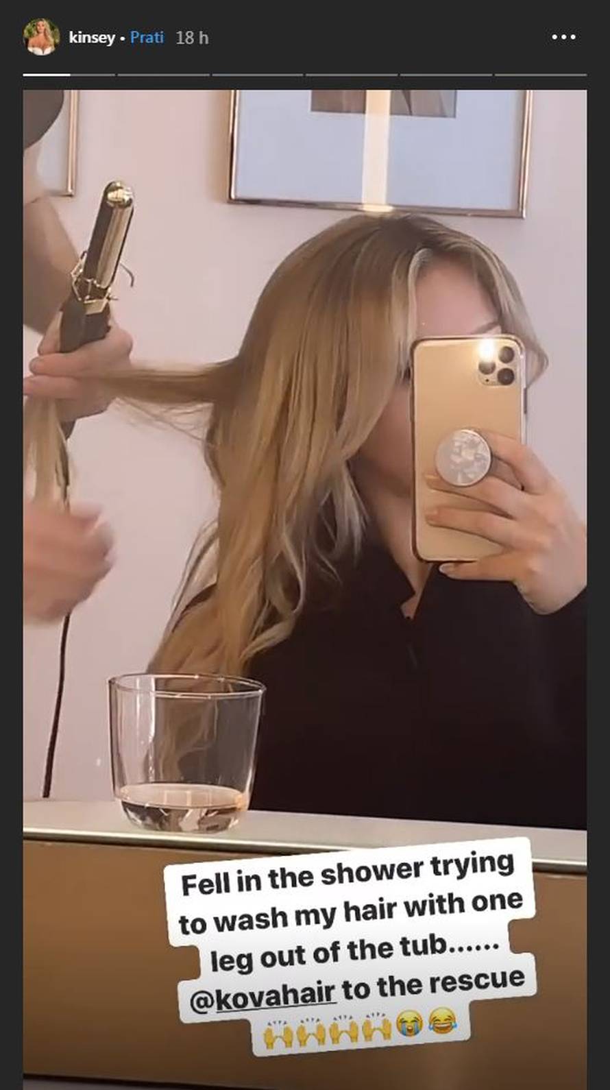 Kinsey slomila gležanj: 'Ali ću i dalje objavljivati fotke za vas...'