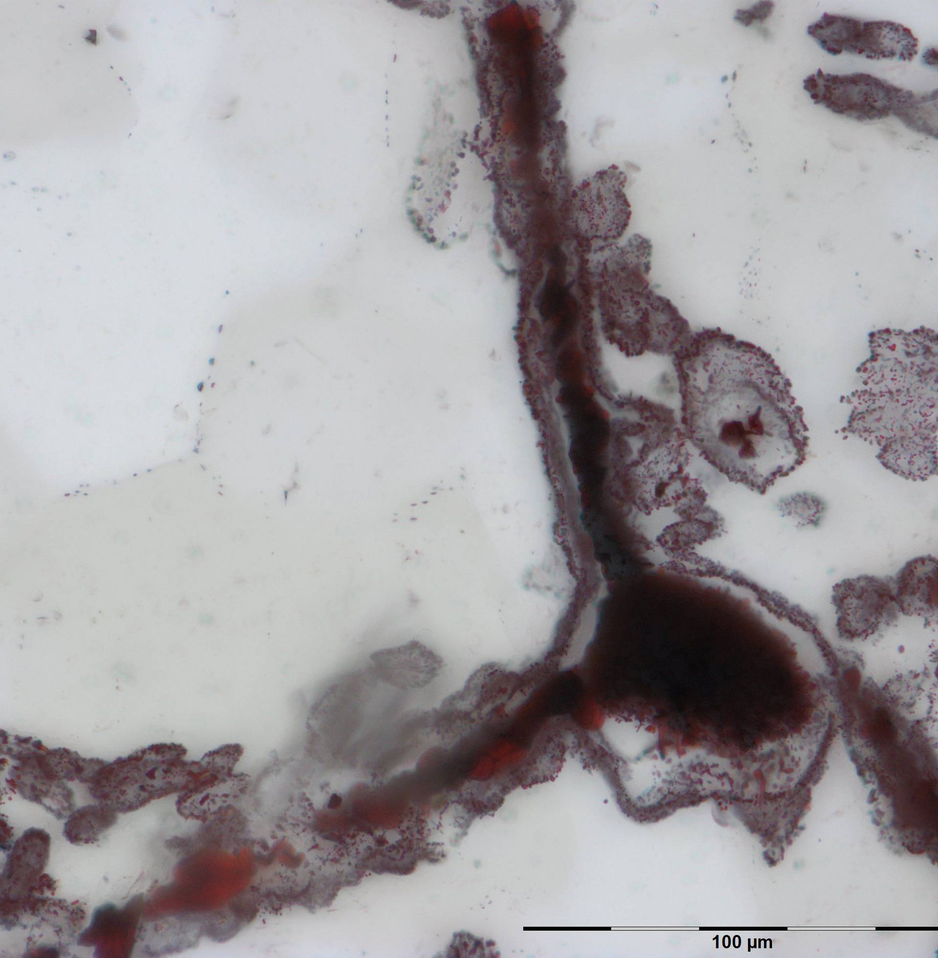 A haematite filament attached to a clump of iron (in the lower right), from hydrothermal vent deposits in the Nuvvuagittuq Supracrustal Belt in QuÃ©bec, Canada is pictured in this handout photo