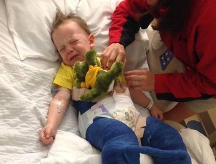 Dječak (3) slomio bedrenu kost na trampolinu - to nije igračka