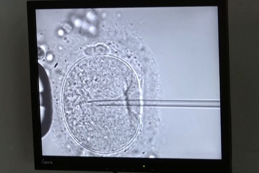 Hrvatski ginekolog o bebi staroj 31 godinu: 'Ovo je ravno &ccaron;udu. U teoriji je mogu&cacute;e, prakti&ccaron;ki nije'