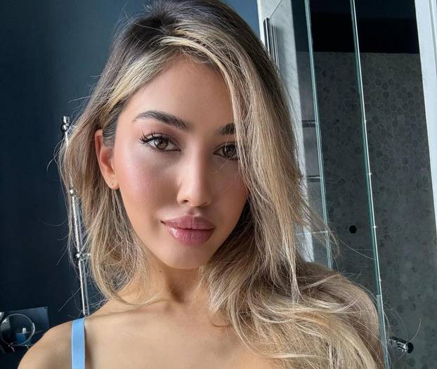 FOTO Sve joj je na mjestu! Prije su je ismijavali, danas zarađuje ogromne cifre kao model