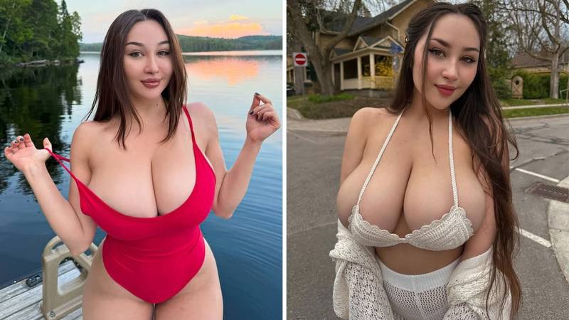 FOTO Ukrajinsku ljepoticu grudi su proslavile, a sada ih želi smanjiti: 'Svi bulje u mene'