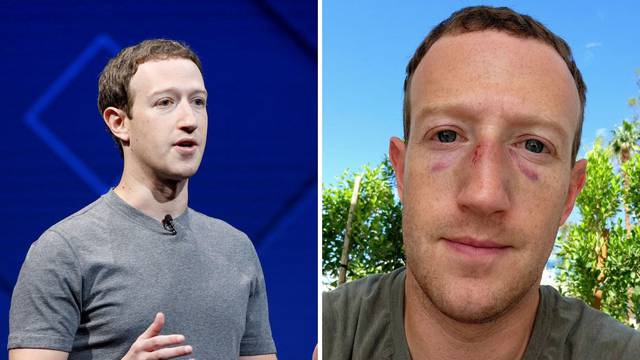 Mark Zuckerberg je 'zaradio' masnice na oba oka: Za sve je zaslužan njegov novi hobi...