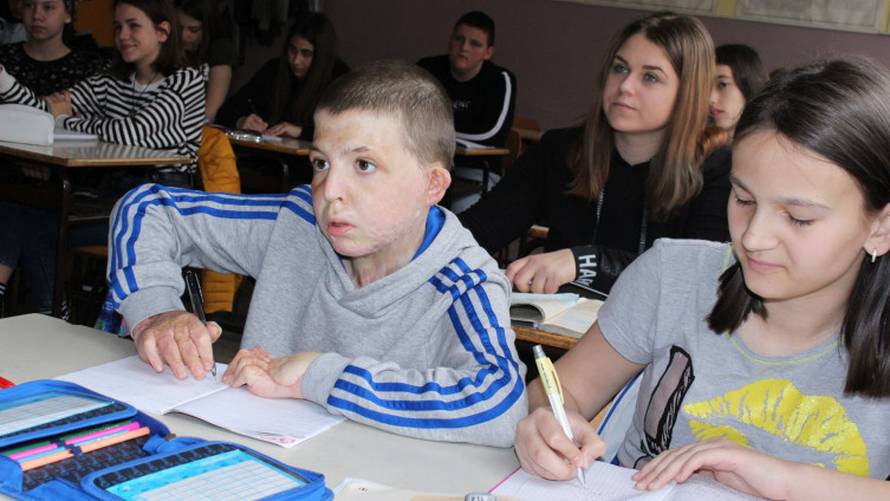 Izgorjelo mu 70% tijela: Meho je nakon operacija opet u školi