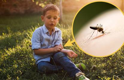 Trikovi kako zaustaviti svrab nakon što vas ubode komarac