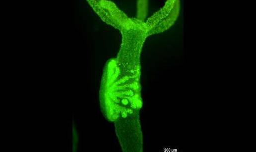 Hrvat dokazao da su tumori stari 600 milijuna godina 
