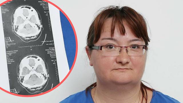 Strava: 'Na pregled čekam čak godinu i pol, a tumor mi raste'