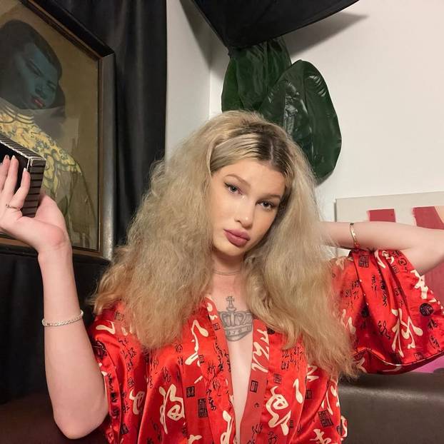 FOTO Htjela je biti žena mačka, a sad plače: Dala sam 7000 €, a fileri su me unakazili! Pomiču se