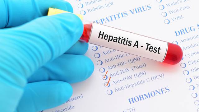 U Rijeci besplatno i anonimno testiranje na hepatitis i HIV