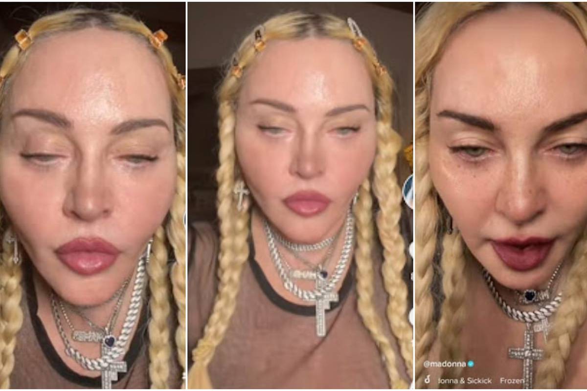 Madonna, što ti se dogodilo?