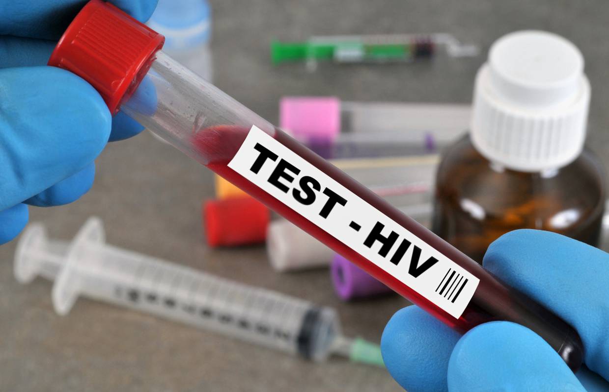 Desetljeća istraživanja HIV-a, a cjepivo još uvijek ne postoji