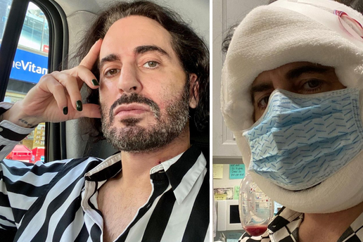 Dizajner Marc Jacobs podvrgnuo se faceliftingu, operaciju platio 315 tisuća kuna: 'Sretan sam'