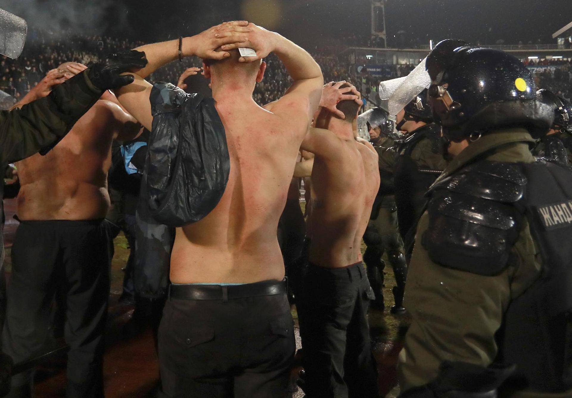 Police escort the soccer fans injured during the fights at a match between Red Star and Partizan in Belgrade