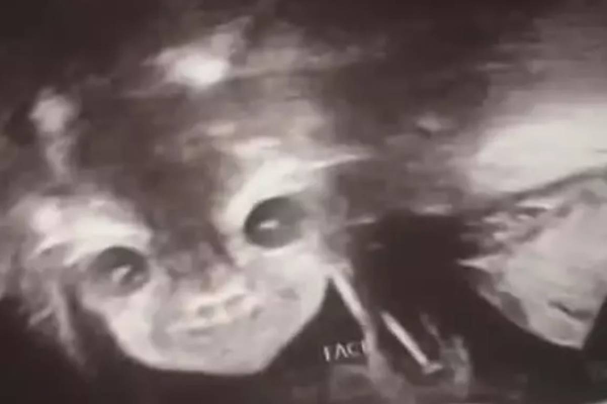 Šokirana slikom s ultrazvuka: 'Moja beba izgleda kao demon'