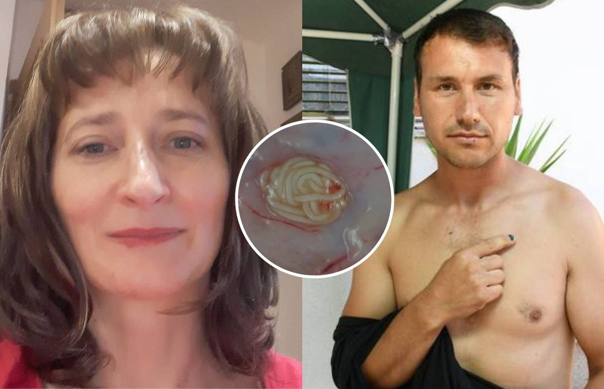 Parazite osjete pod kožom, a liječnici im ne mogu pomoći: Saznajte koji su najopasniji
