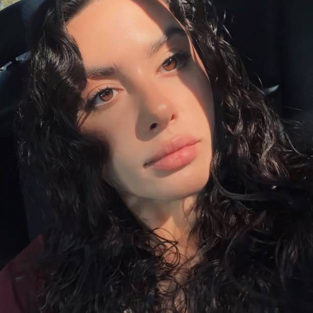 FOTO Putinova ljubimica imala je velike planove. Morala je na operaciju i tu joj je počeo pakao