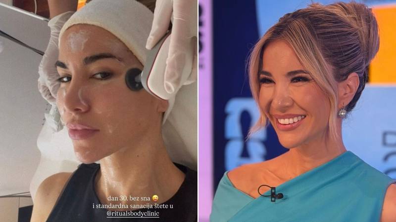 FOTO Valentina otkrila tajnu: Evo koji joj tretman pomaže nakon neprospavanih noći