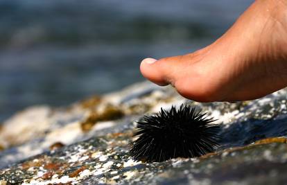 Prva pomoć na plaži: Ubodete li se na ježa, ako meduza opeče