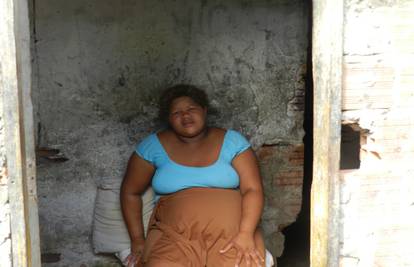 Šok u Brazilu: Doktori otkinuli glavu djetetu tijekom porođaja