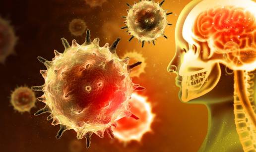 U Engleskoj se &scaron;iri smrtonosna bolest. Umrlo dvoje mladih. Evo koji su simptomi meningitisa